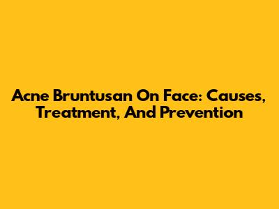Acne Bruntusan On Face: Causes, Treatment, And Prevention