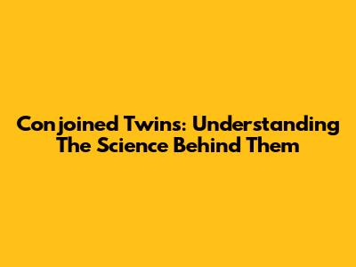 Conjoined Twins: Understanding The Science Behind Them