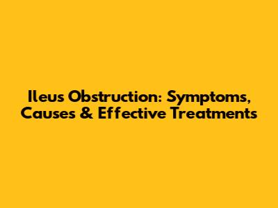Ileus Obstruction: Symptoms, Causes & Effective Treatments