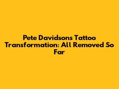 Pete Davidson's Tattoo Transformation: All Removed So Far