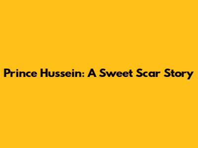 Prince Hussein: A Sweet Scar Story