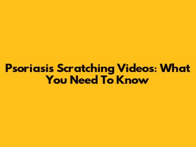 Psoriasis Scratching Videos: What You Need To Know