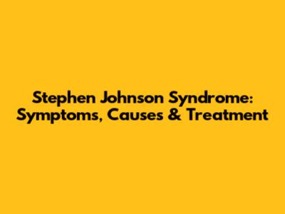 Stephen Johnson Syndrome: Symptoms, Causes & Treatment