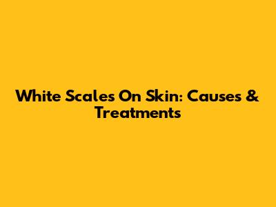 White Scales On Skin: Causes & Treatments